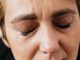 Thyroid Eye Disease